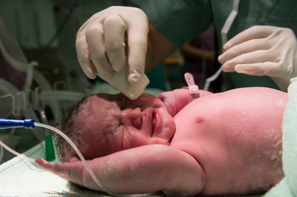 Newborn baby receiving post-delivery care after normal delivery in Indore
