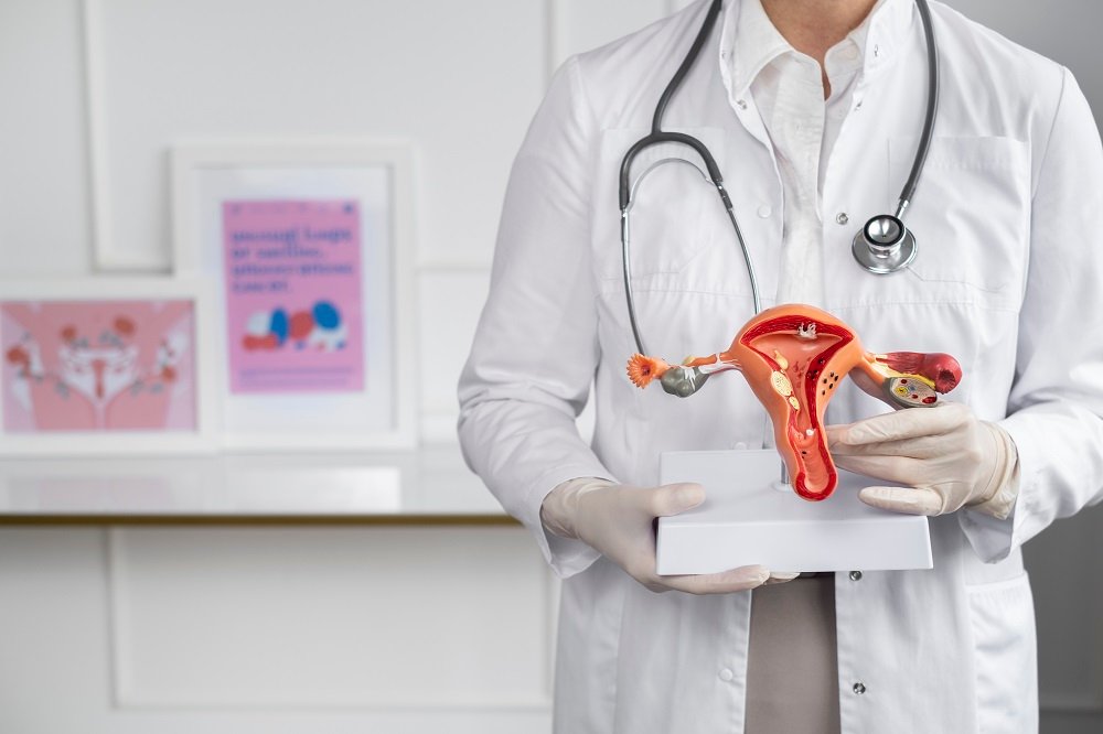 Gynecologist holding female reproductive system model for PCOS and gynecology treatment in Indore
